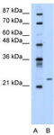 Polyamine Modulated Factor 1 antibody, TA332013, Origene, Western Blot image 