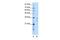 Ribosome Production Factor 1 Homolog antibody, GTX47248, GeneTex, Western Blot image 