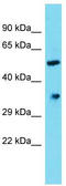 Dehydrogenase/Reductase 12 antibody, TA335876, Origene, Western Blot image 