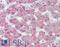 Probable G-protein coupled receptor 146 antibody, LS-A1987, Lifespan Biosciences, Immunohistochemistry paraffin image 