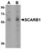 Scavenger Receptor Class B Member 1 antibody, TA306788, Origene, Western Blot image 