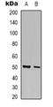 FYN Binding Protein 1 antibody, orb74859, Biorbyt, Western Blot image 