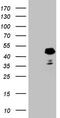 Doublesex And Mab-3 Related Transcription Factor 1 antibody, TA807504S, Origene, Western Blot image 