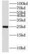 MOB Kinase Activator 3A antibody, FNab05260, FineTest, Western Blot image 