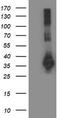 Sirtuin 5 antibody, CF503232, Origene, Western Blot image 