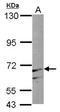 3'-Phosphoadenosine 5'-Phosphosulfate Synthase 1 antibody, NBP1-33470, Novus Biologicals, Western Blot image 