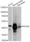 Pyruvate Dehydrogenase E1 Alpha 2 Subunit antibody, A14994, ABclonal Technology, Western Blot image 