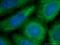 ATX2 antibody, 21776-1-AP, Proteintech Group, Immunofluorescence image 