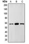 Alpha-ketoglutarate-dependent dioxygenase FTO antibody, orb215283, Biorbyt, Western Blot image 