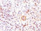 BAX antibody, AM50160PU-S, Origene, Immunohistochemistry paraffin image 