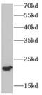Adaptor Related Protein Complex 3 Subunit Sigma 2 antibody, FNab00468, FineTest, Western Blot image 