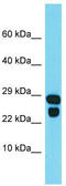 Probable gluconokinase antibody, TA332350, Origene, Western Blot image 