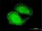 Tensin 4 antibody, H00084951-M01, Novus Biologicals, Immunocytochemistry image 