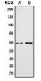 Cytochrome P450 Family 4 Subfamily A Member 11 antibody, orb213830, Biorbyt, Western Blot image 