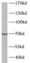 ATP Binding Cassette Subfamily G Member 2 (Junior Blood Group) antibody, FNab00855, FineTest, Western Blot image 