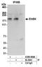 Receptor tyrosine-protein kinase erbB-4 antibody, A300-666A, Bethyl Labs, Immunoprecipitation image 