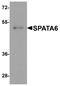 Spermatogenesis Associated 6 antibody, A14863, Boster Biological Technology, Western Blot image 