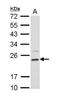 Dihydrofolate Reductase antibody, NBP2-16163, Novus Biologicals, Western Blot image 