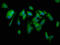 CutC Copper Transporter antibody, LS-C672188, Lifespan Biosciences, Immunofluorescence image 