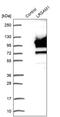 E3 ubiquitin-protein ligase LRSAM1 antibody, PA5-54397, Invitrogen Antibodies, Western Blot image 