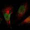 Zinc Finger And BTB Domain Containing 38 antibody, HPA014865, Atlas Antibodies, Immunofluorescence image 