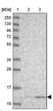 Ubiquinol-Cytochrome C Reductase Hinge Protein antibody, NBP1-93442, Novus Biologicals, Western Blot image 