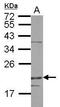 DRP1 antibody, GTX115106, GeneTex, Western Blot image 