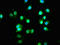 Family With Sequence Similarity 83 Member G antibody, LS-C680448, Lifespan Biosciences, Immunofluorescence image 