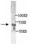 Adrenoceptor Alpha 1D antibody, TA310100, Origene, Western Blot image 