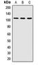 Peroxisomal Biogenesis Factor 6 antibody, LS-C667955, Lifespan Biosciences, Western Blot image 