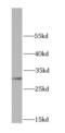 HUS1 Checkpoint Clamp Component antibody, FNab04082, FineTest, Western Blot image 