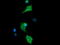 Cancer/Testis Antigen 1B antibody, LS-C338021, Lifespan Biosciences, Immunofluorescence image 