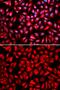 Importin 5 antibody, GTX32684, GeneTex, Immunofluorescence image 