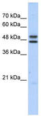 ERCC Excision Repair 8, CSA Ubiquitin Ligase Complex Subunit antibody, TA344282, Origene, Western Blot image 