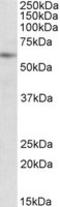 Protein Inhibitor Of Activated STAT 2 antibody, LS-C112943, Lifespan Biosciences, Western Blot image 