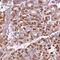 Ceroid-lipofuscinosis neuronal protein 6 antibody, NBP2-39066, Novus Biologicals, Immunohistochemistry paraffin image 