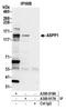 Protein Phosphatase 1 Regulatory Subunit 13B antibody, A300-918A, Bethyl Labs, Immunoprecipitation image 