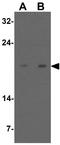 Succinate Dehydrogenase Complex Assembly Factor 1 antibody, GTX17172, GeneTex, Western Blot image 