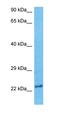 Heat Shock Transcription Factor 1 antibody, orb333111, Biorbyt, Western Blot image 