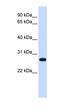 Synaptosome Associated Protein 23 antibody, orb330560, Biorbyt, Western Blot image 