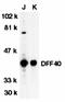 DNA Fragmentation Factor Subunit Beta antibody, orb74381, Biorbyt, Western Blot image 