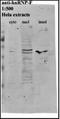 Heterogeneous Nuclear Ribonucleoprotein F antibody, orb76668, Biorbyt, Western Blot image 