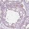 Sterile Alpha Motif Domain Containing 4A antibody, HPA065309, Atlas Antibodies, Immunohistochemistry paraffin image 