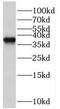RBM4B antibody, FNab07182, FineTest, Western Blot image 