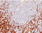 CD5 Molecule antibody, AM50237PU-T, Origene, Immunohistochemistry paraffin image 