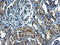 Methyltransferase Like 25 antibody, LS-C788566, Lifespan Biosciences, Immunohistochemistry paraffin image 