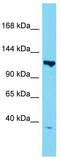 TATA-Box Binding Protein Associated Factor 3 antibody, TA331447, Origene, Western Blot image 