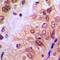 ABL Proto-Oncogene 1, Non-Receptor Tyrosine Kinase antibody, LS-C358410, Lifespan Biosciences, Immunohistochemistry paraffin image 