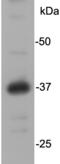 GTP-binding protein REM 2 antibody, TA321941, Origene, Western Blot image 