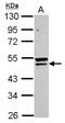 Queuine TRNA-Ribosyltransferase Accessory Subunit 2 antibody, NBP2-20031, Novus Biologicals, Western Blot image 